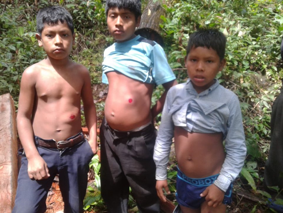 Just got back from a (very fun) charity event to help some indigenous NgÃ¤be-BuglÃ© people who were illegally and violently evicted to make room for a hydro dam. Rubber bullets used on children.

Property rights are so important for a humane society. You can't ruin a river ecosystem people depend on without any penalty. And for what? Panama already produces twice the electricity it uses.

They can't eat electricity, and the land is legally theirs.